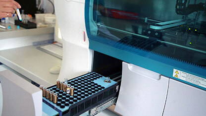 Still Image of High Technology Hospital Laboratory Equipment Laboratory Assistant Working With Automatic Biochemical Analyzer Close Up Woman Hand With Blood Analyzing Test Tube Modern Biotechnology Diagnostic